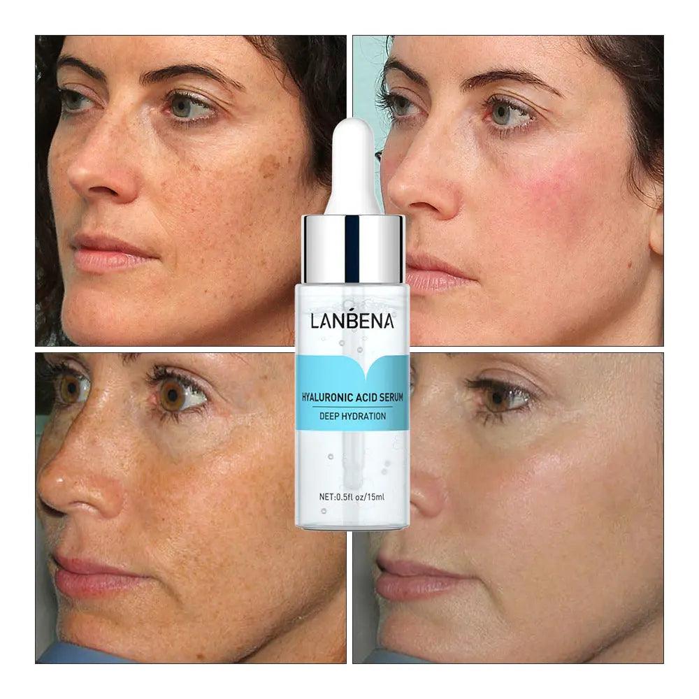 MMU014 LANBENA Hyaluronic Acid Serum - Mariam's Collection